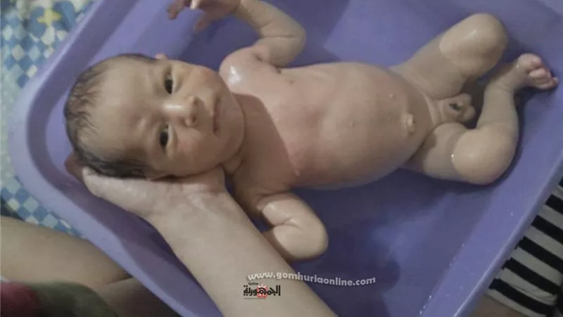 حبس ممرضة 4 أيام في بتر عضو ذكري لطفل بسبب جراحة ختان