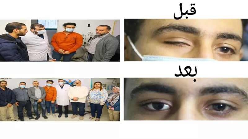 إجراء عملية تركيب عين صناعية متحركة بمستشفى الغردقة العام