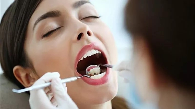 5 نصائح للحفاظ على صحة الاسنان..تعرف عليها