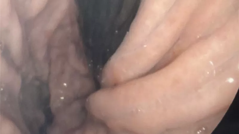 إجراء ١٣ منظار جهاز هضمي بمستشفى بلبيس