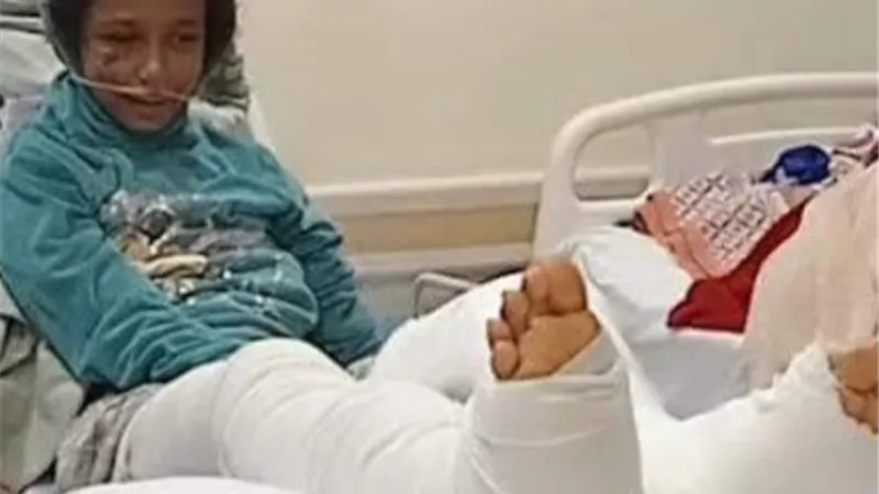 إصابة طفلة بكسر مضاعف إثر سقوط عمود إنارة عليها