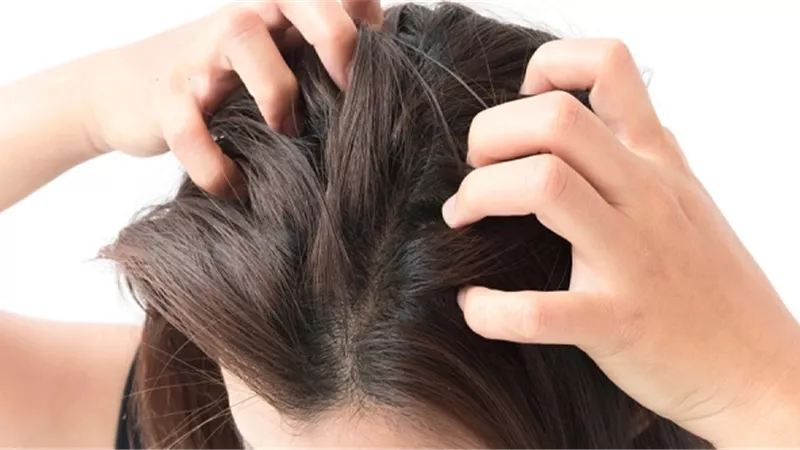 حكة الرأس تشير الى هذا المرض .. خبراء يحذرون