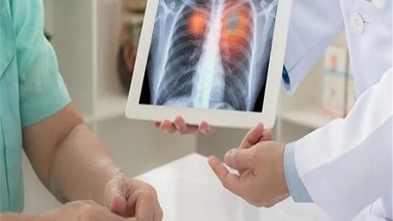 لمرضى الربو.. نصائح هامة لتجنب المضاعفات أثناء التقلبات الجوية