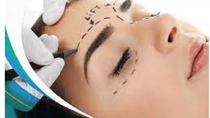 عمليات تجميل رفع الحواجب لاجل ازالة اثار الشيخوخة