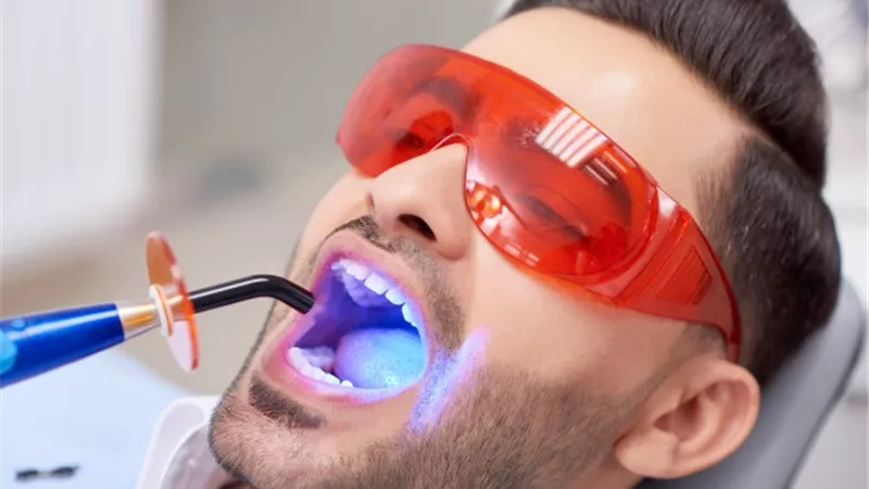 تبييض الأسنان بالليزر هل يعتبر تغييرًا لخلق الله