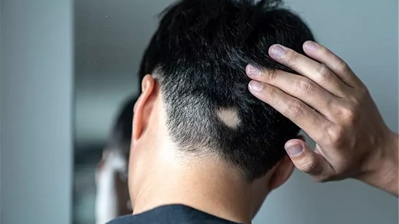 علاج جديد لـ 