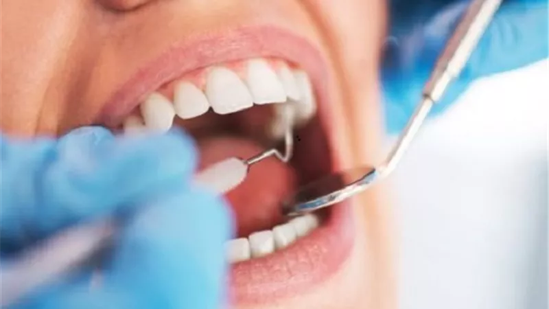 طبيبة: عدم علاج تسوس الأسنان يؤدي إلى عواقب وخيمة للصحة