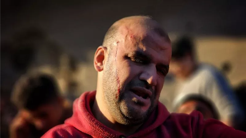 إصابة 3 فلسطينيين في عملية قنص نفذها جيش الاحتلال بمحيط الشفاء