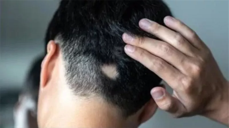 علامة تظهر بالرأس لـ