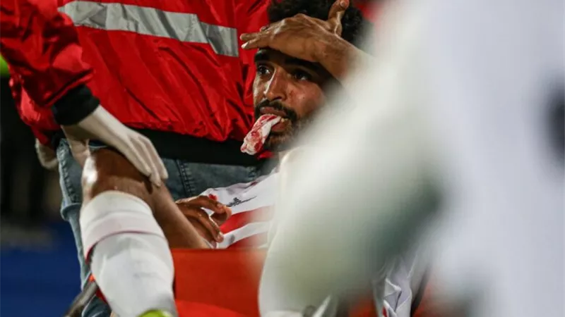 بعد إصابته بكسر في الفك..عودة أوباما لتدريبات الزمالك