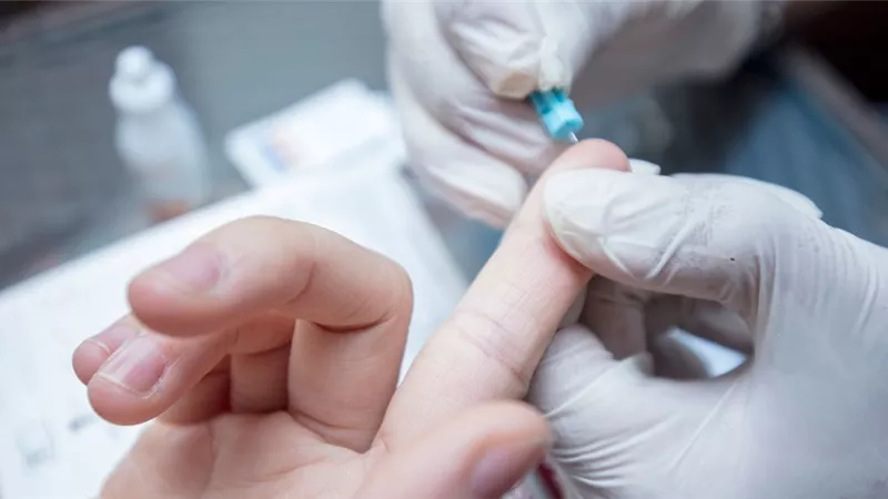 إصابة ثلاث نساء بالإيدز والسبب عمليات التجميل