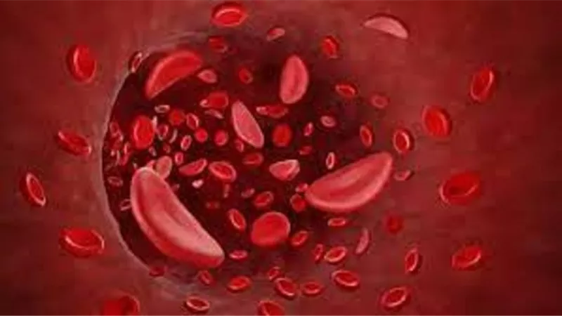 أبرزها النظافة الشخصية .. 5 نصائح مهمة لمرضى الثلاسيميا