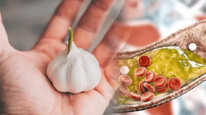 أكلات تقلل الكوليسترول والدهون الثلاثية أهمها .. الثوم والسمك