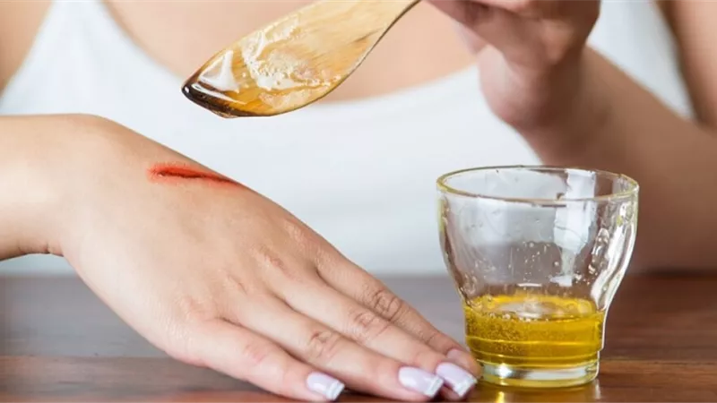 طبيب: العسل يسرع عملية التئام الجروح والخدوش