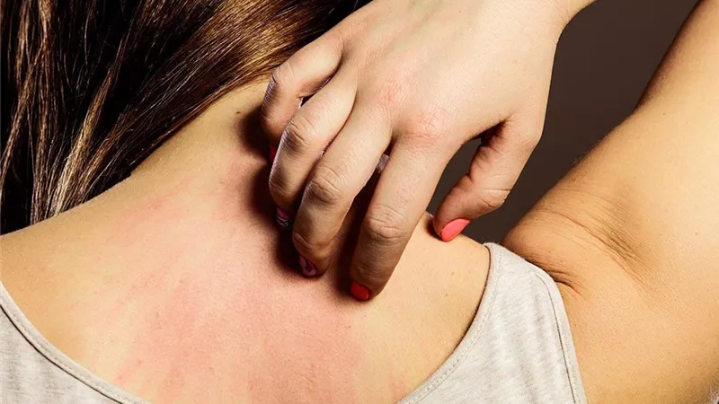 تعرف على اهم اسباب حساسية الطعام