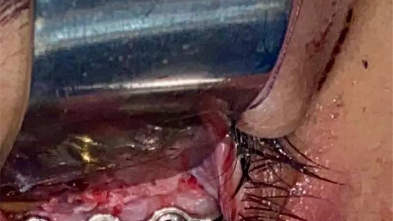 بمستشفى ادكو المركزى جراحة ناجحة لطفلة سقطت من الرابع