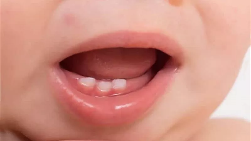 النوم على البطن من أسباب اعوجاج الأسنان اللبنية عند الرضع