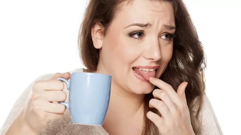 4 نصائح يجب اتباعها عند الإصابة بحروق اللسان