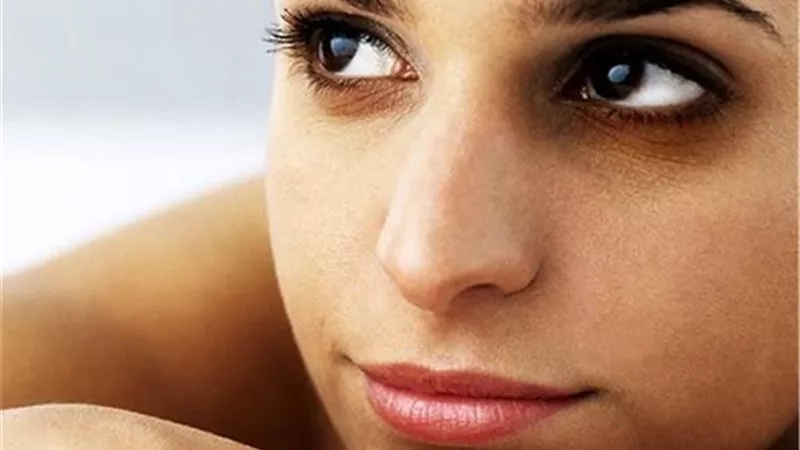 10 أسباب غير متوقعة للهالات السوداء يجب الانتباه لها