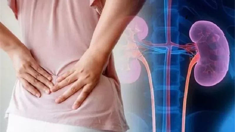 طبيب: الأرق والتعب أبرز أعراض أمراض الكلى