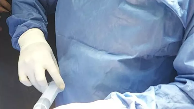 علاج فتق ضخم معقد بتقنيّة جراحية دون عناية مركزة في مستشفى قنا