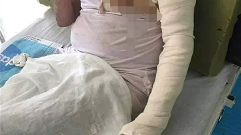 حاول الدفاع عن جاره.. إشعال النيران في محامي بالشرقية