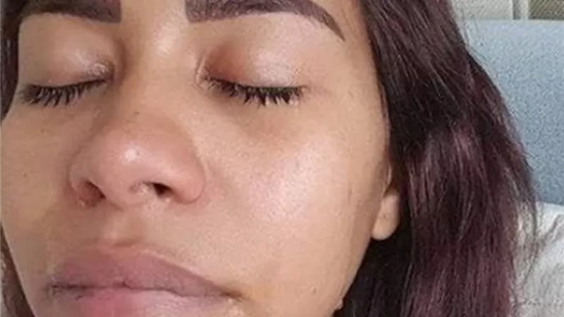 بعد اعتداء حسام حبيب.. مفاجأة في التقرير الطبي لـ شيرين عبد الوهاب
