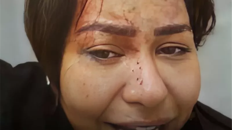الفنانة شيرين تلازم الفراش وحالتها النفسية لا تسمح باستجوابها