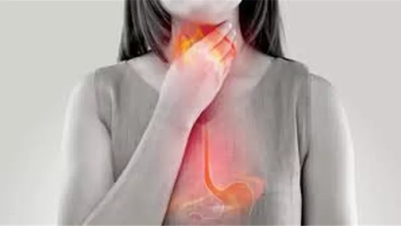 النزيف .. أبرز مضاعفات ارتجاع المرئ