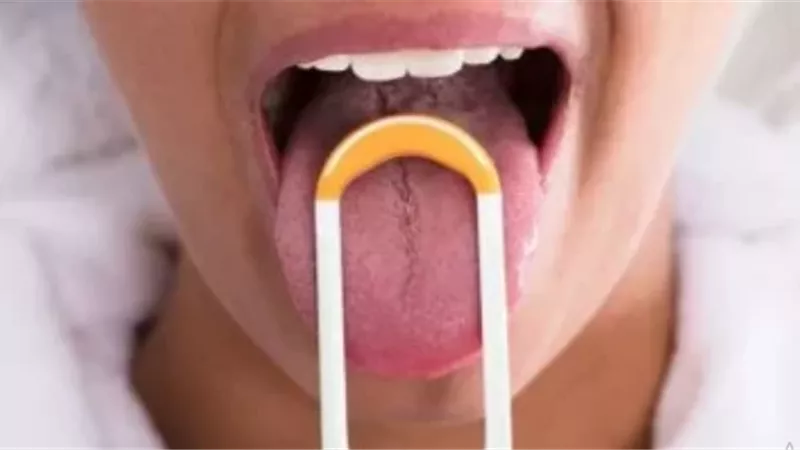 احذر هذه التغيرات في لون فمك .. تشير إلى مرض خطير
