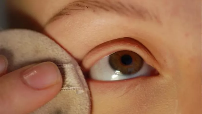 أسباب تساقط الرموش