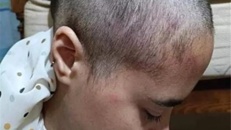 ضبط المتهم بتعذيب ابنته وحلق شعرها في المقطم