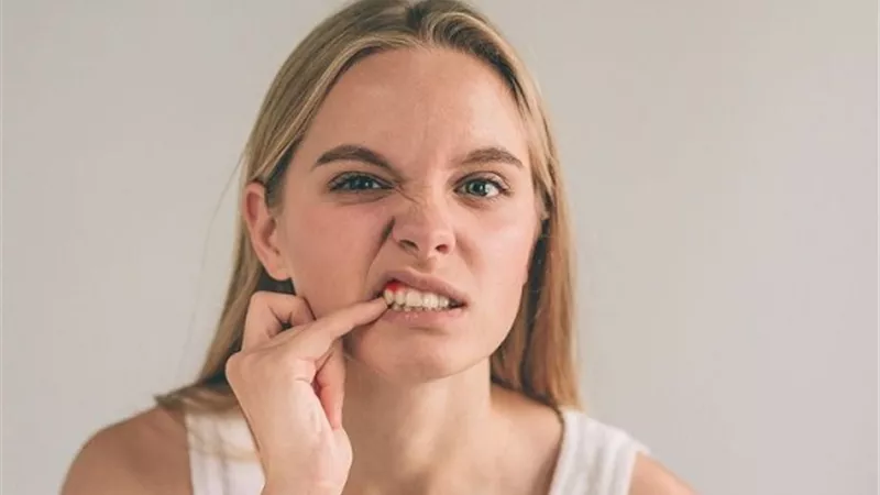 أبرزها رائحة الفم الكريهة .. أعراض حكة اللثة