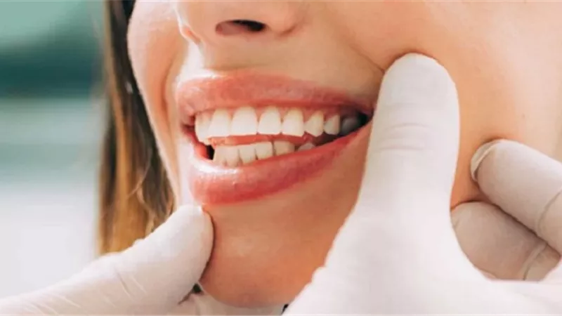 7 طرق لعلاج حكة اللثة
