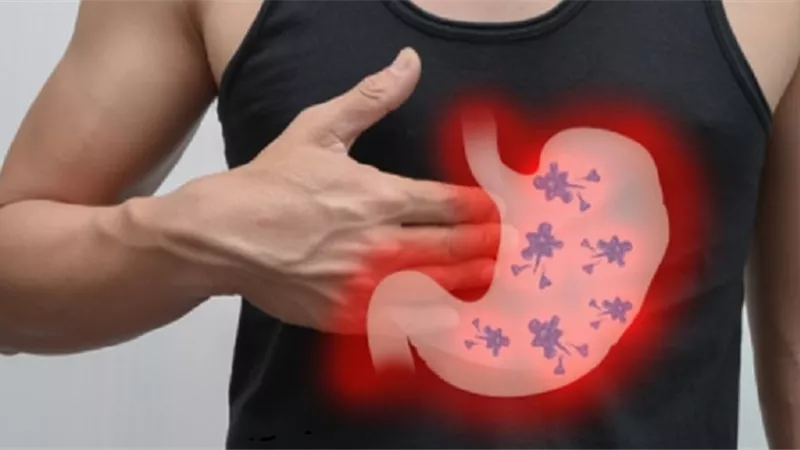 جرثومة المعدة .. الأسباب والأعراض وطرق العلاج