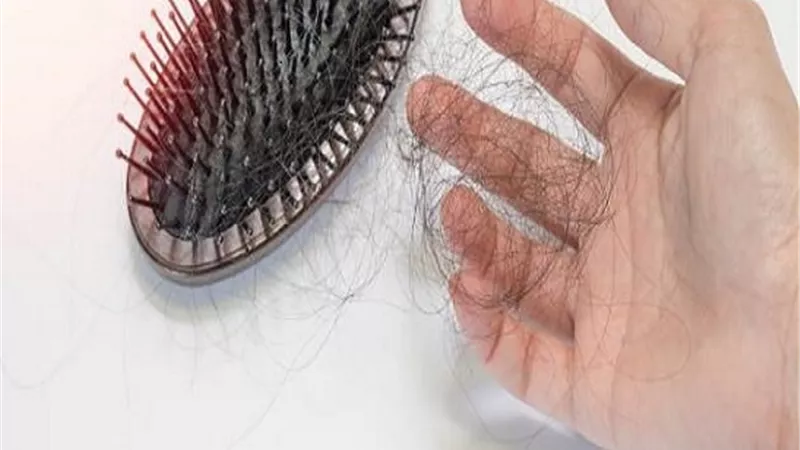 تعرف على الكمية الطبيعية لتساقط الشعر في اليوم