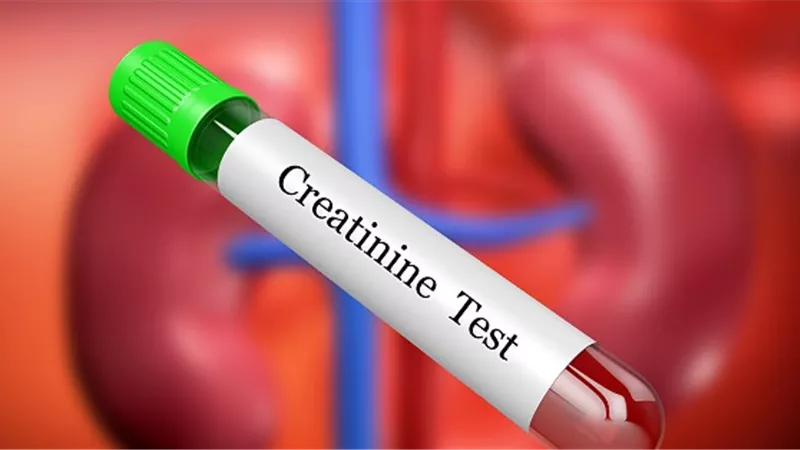 أعراض ارتفاع مستوى الكرياتينين
