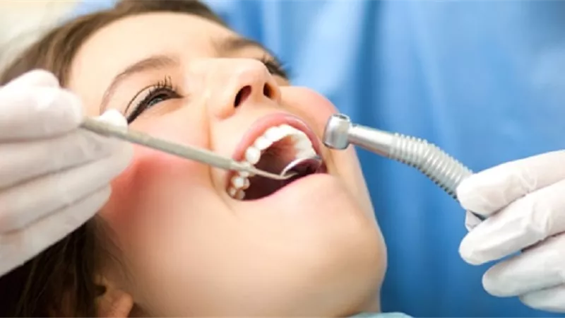 طبيبة أسنان تكشف الوقت المناسب لخلع أضراس العقل