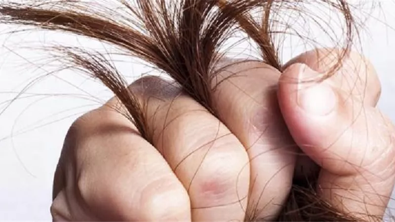 العوامل الكيميائية .. أهم أسباب تلف الشعر وجفافه