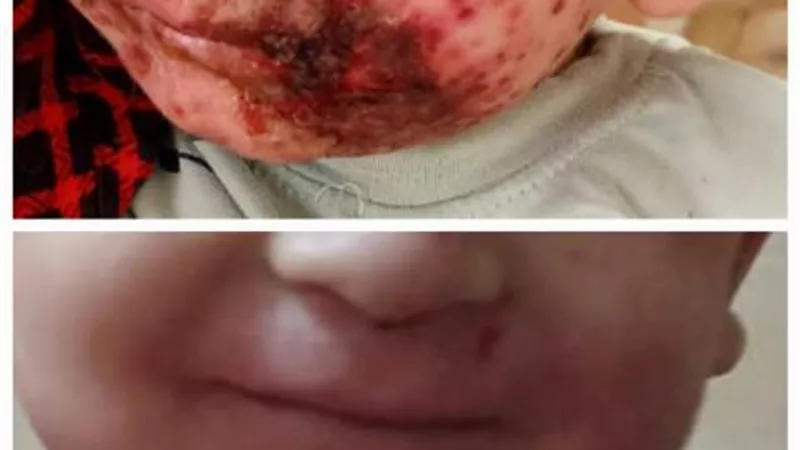 فريق طبى لتشخيص حالة طفل بحميات بنى سويف