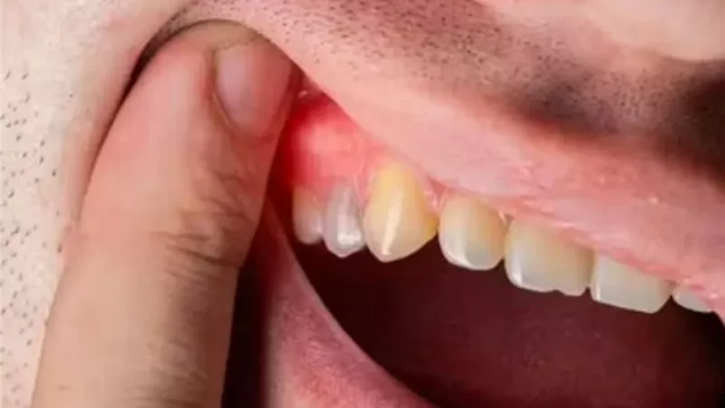 8 أسباب غير متوقعة لالتهابات الأسنان