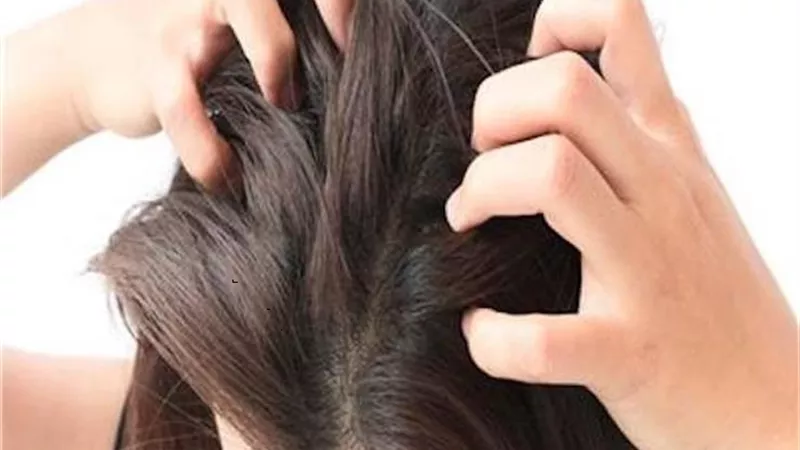 أسباب تؤدى لرائحة فروة رأس كريهة