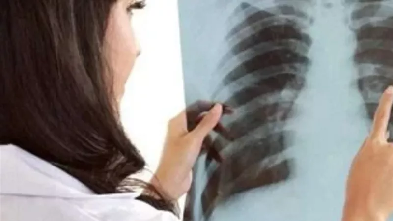 أمراض أثارت حيرة الأطباء وملهاش علاج