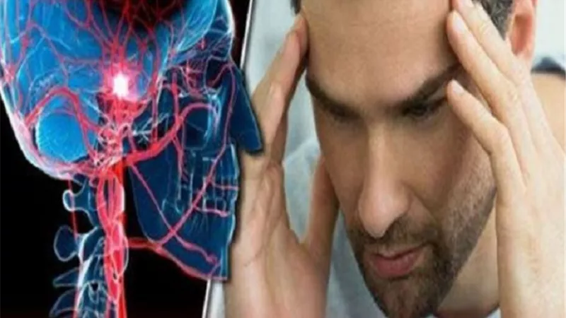 تأثير المشروبات الغازية على السكتة الدماغية