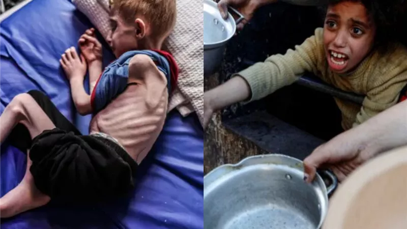 الموت جوعا .. يتصاعد في غزة