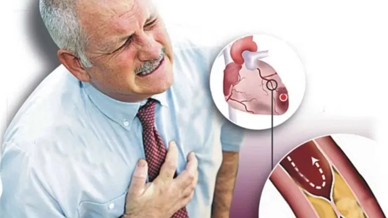 4 نصائح هامة لمرضى ضغط الدم والكوليسترول والشريان التاجي