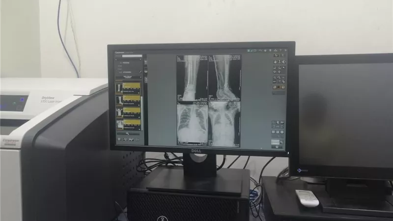 وزيرالصحةيدعم مستشفى الزقازيق وابوكبير بجهازينDR للأشعة