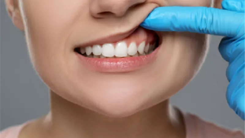 طرق فعالة للتخلص من آلام الضروس