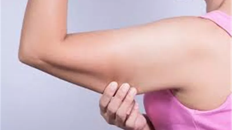 اليك الحل الامثل لعلاج ترهلات الذراعين