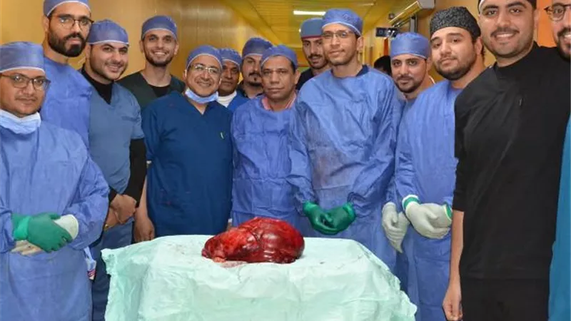 فريق طبي ينجح في استئصال ورم ضخم خلف الغشاء بأسيوط